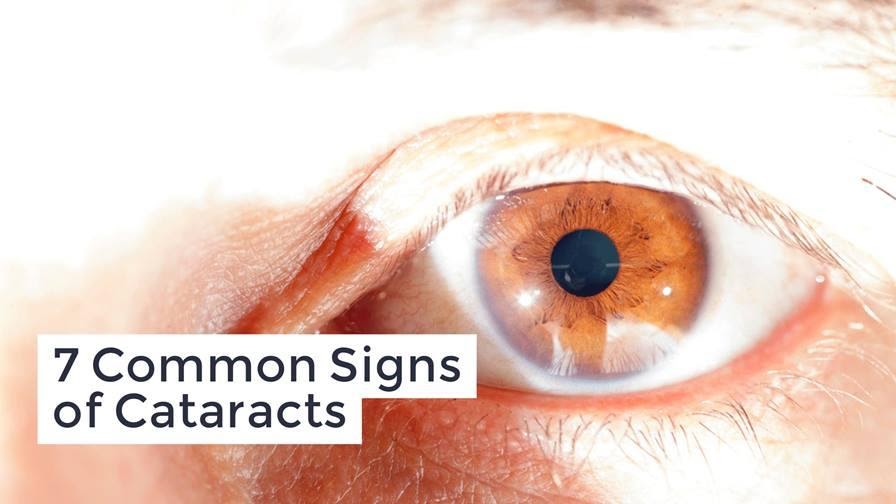 What are the seven symptoms of cataracts?